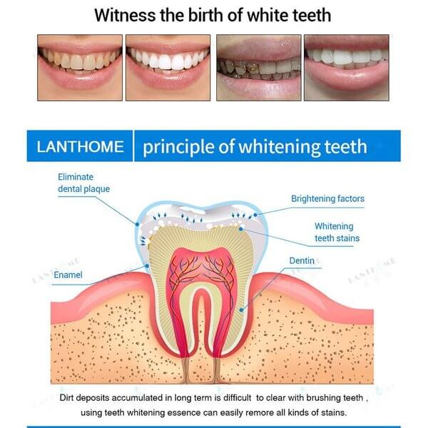 🔥Hot Sale🔥 TEETH WHITENING PENS